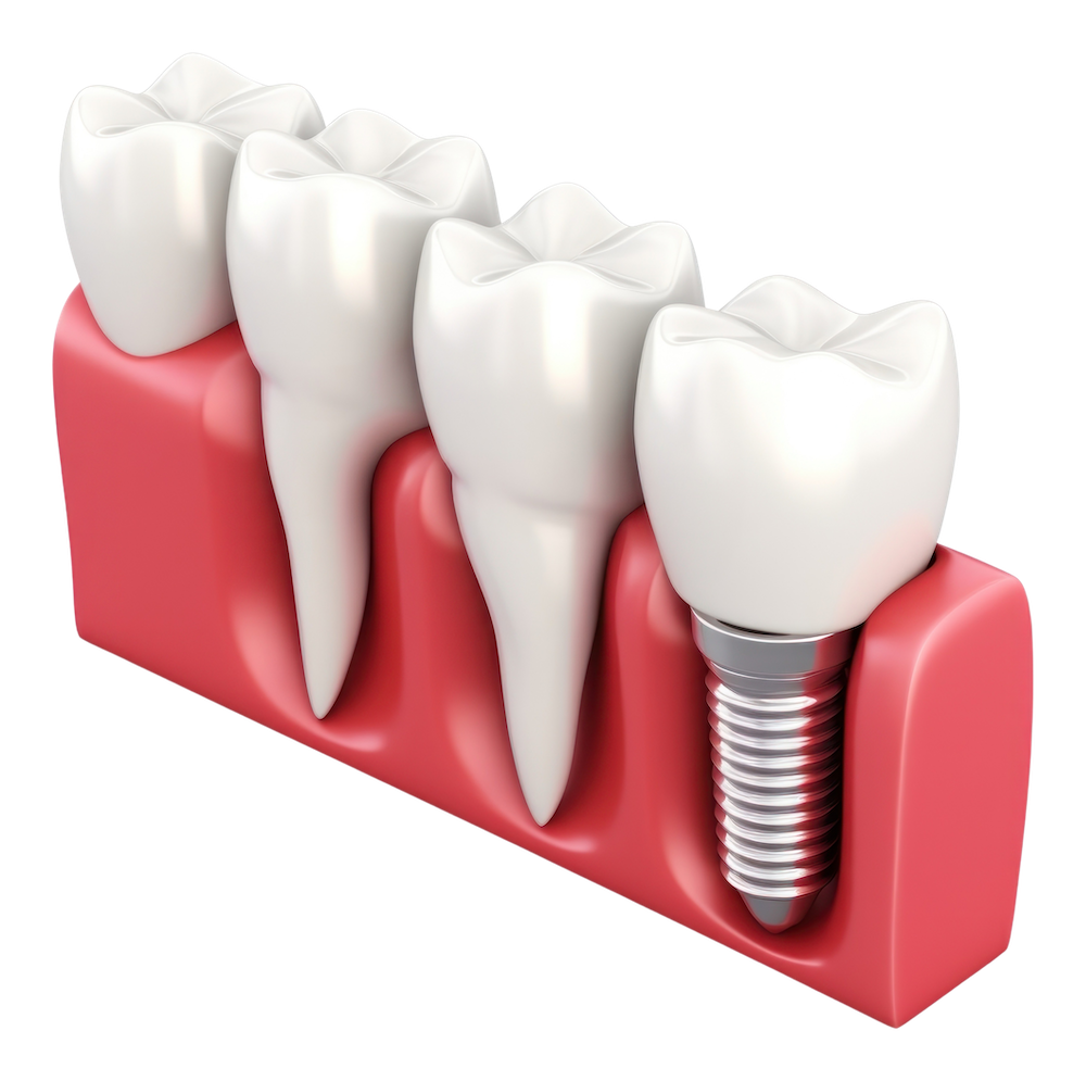 https://firstcitydentalfl.com/wp-content/uploads/2023/12/image-from-rawpixel-id-12655895-original.png